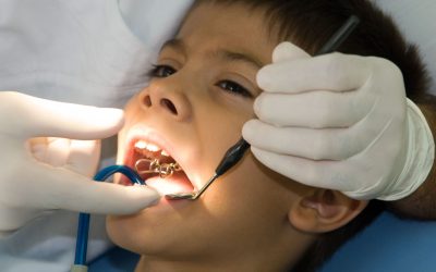 Braces For Adults In Medina OH: Unlock A Confident Smile Today
